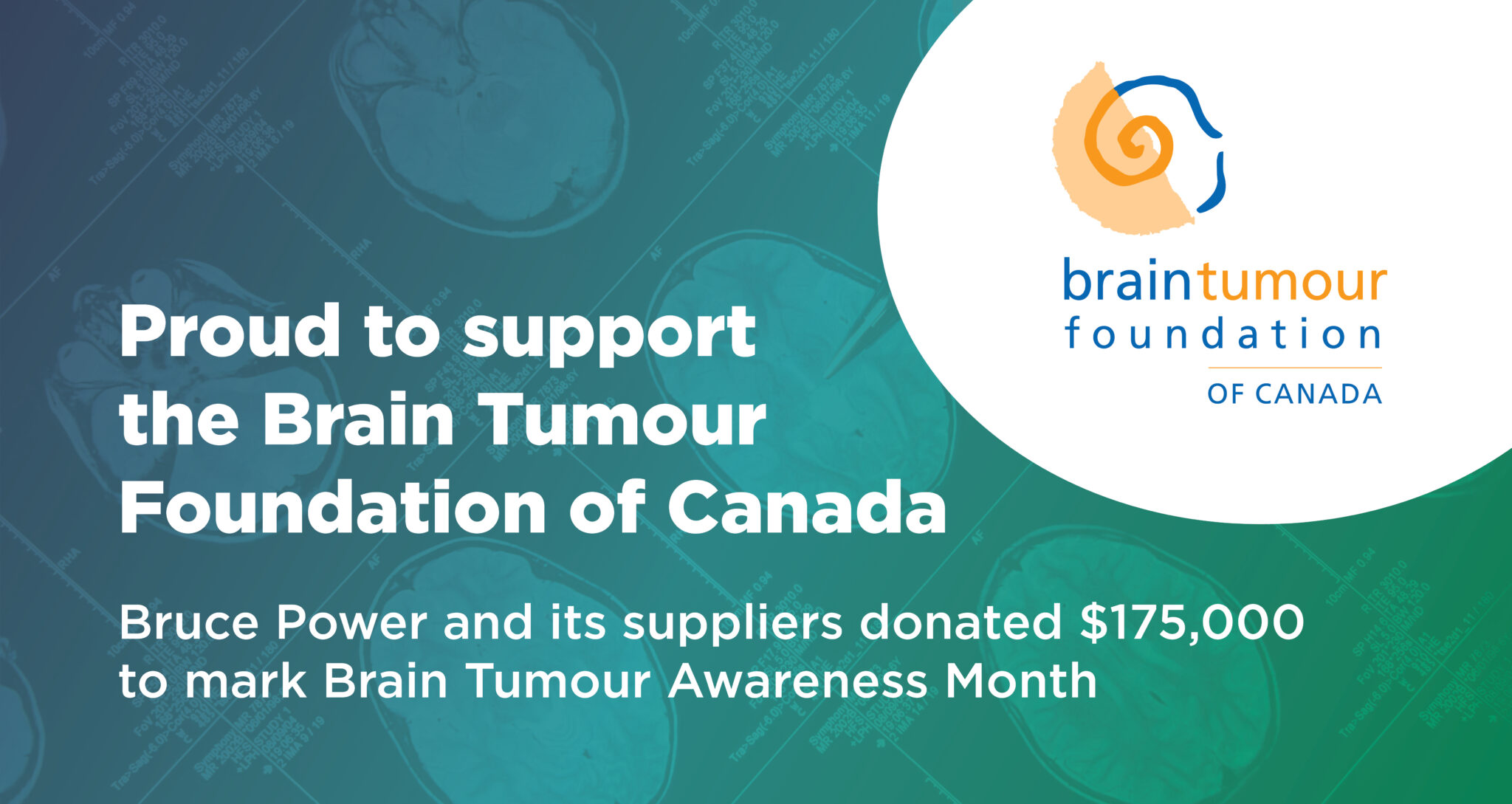Bruce Power and Supplier Partners donate 175,000 to Brain Tumour